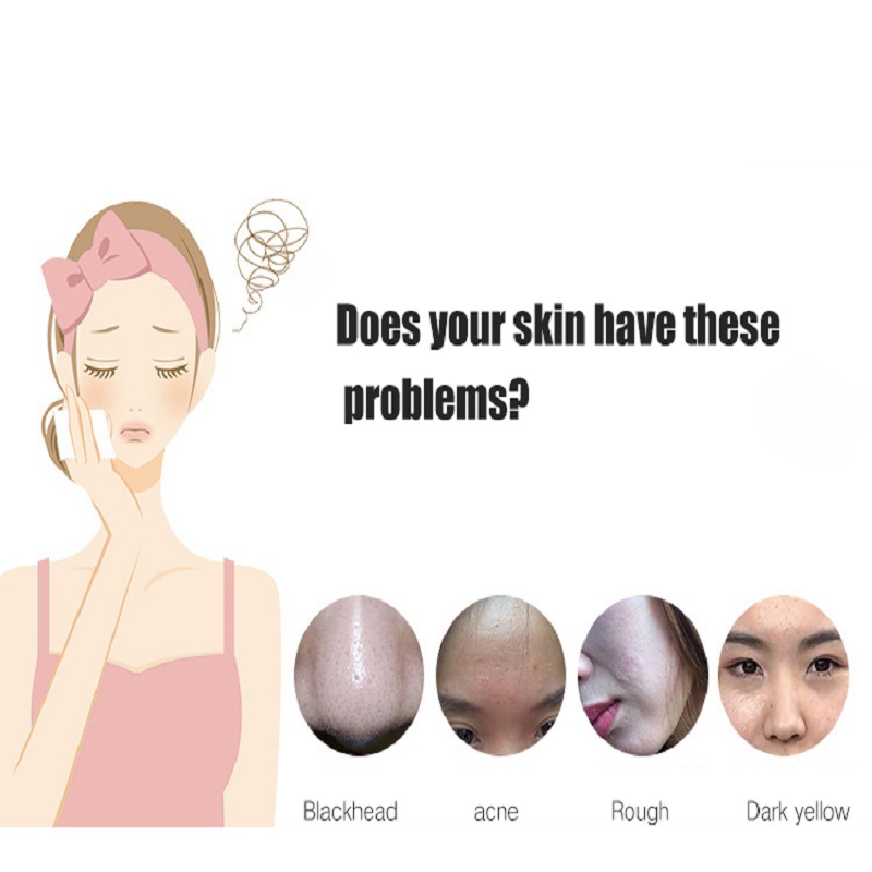 Mélytisztító hámlasztók Bőrfiatalítás Face Lift Arc Ultrahangos Skin Súroló